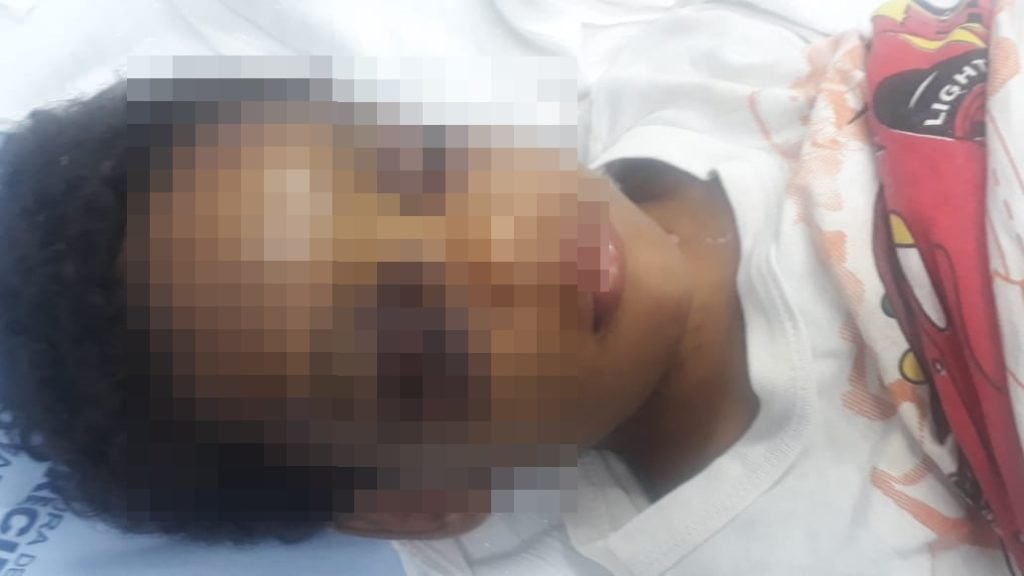 Caso criança agredida: Avó é suspeita e mãe vira testemunha do espancamento