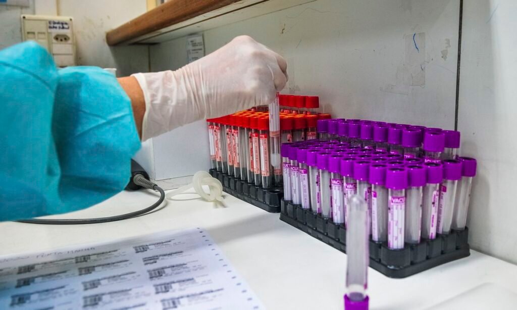 UFRJ desenvolve teste 20 vezes mais barato para detectar coronavírus