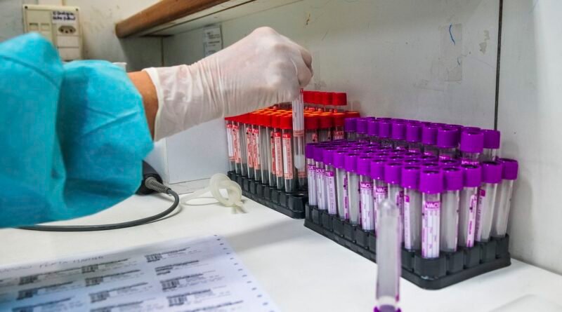 UFRJ desenvolve teste 20 vezes mais barato para detectar coronavírus
