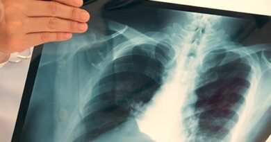 Prefeitura de Goiânia amplia e moderniza diagnóstico precoce de doenças pulmonares